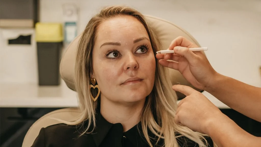 Herstel na een ooglidcorrectie