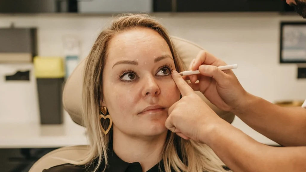 Voorbereiding op een ooglidcorrectie