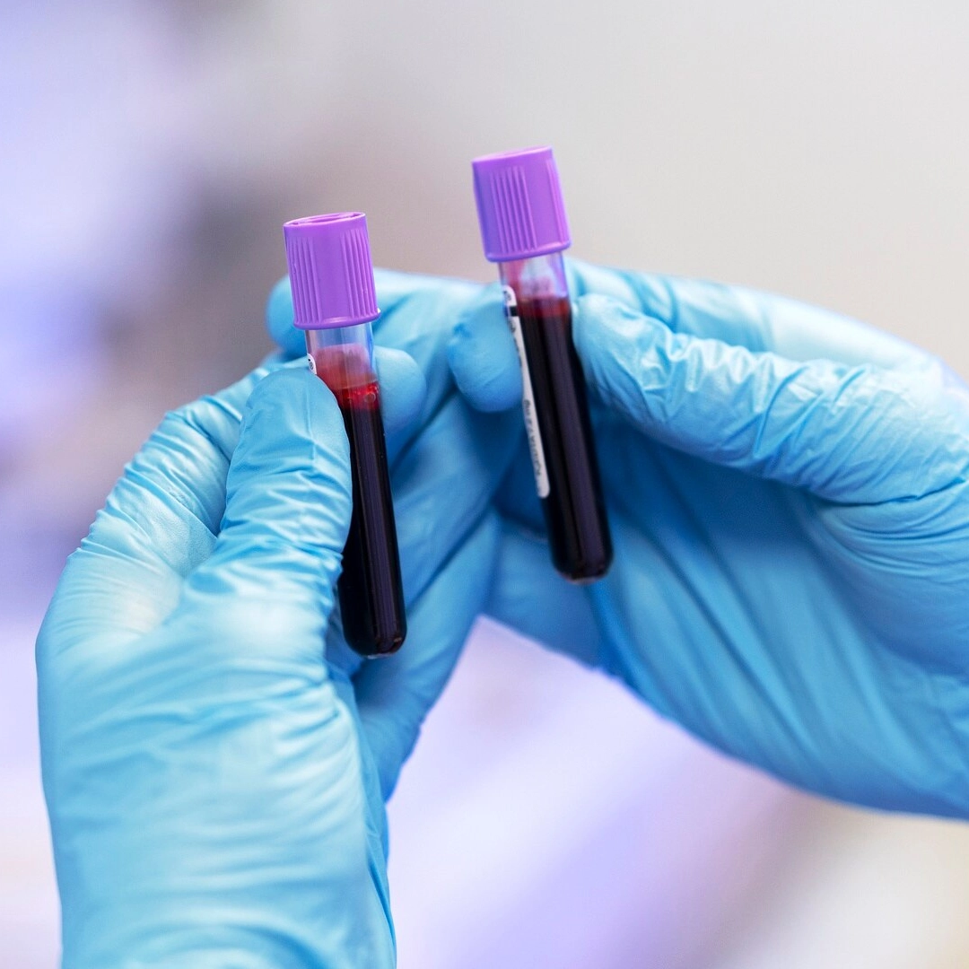 bloedonderzoek mannen vrouwen